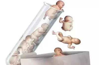体外受精 IVF-ET